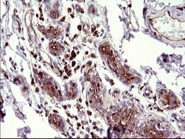 SCAMP2 Antibody (clone OTI3C2)