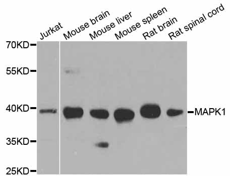 Polyclonal Rabbit anti-Human MAPK1 / ERK2 Antibody (IHC, WB)