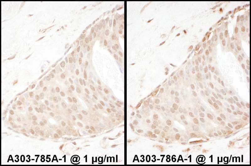 ARRB2 / Beta Arrestin 2 Antibody (aa355-405)