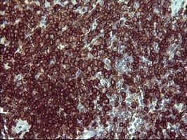 CD45 / LCA Antibody (clone OTI3D1)