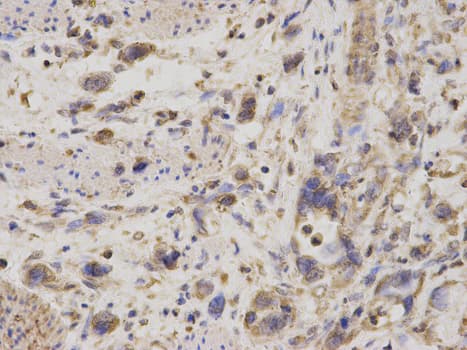 IHC-plus™ GDI1 Antibody