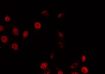 Polyclonal Rabbit anti-Human TRIP13 Antibody (IF, WB)