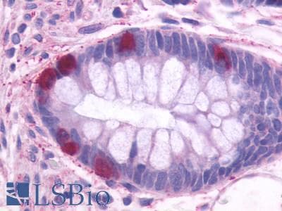 PathPlus™ ADGRE5 / CD97 Antibody (N-Terminus)