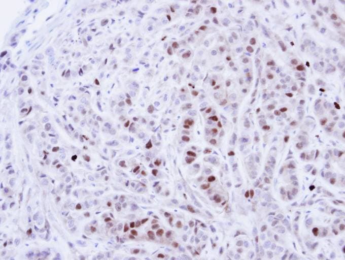 Polyclonal Rabbit anti-Human NEK4 Antibody (aa241-504, IHC, WB)