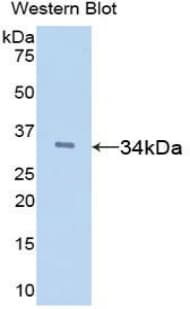 TFPI / LACI Antibody (aa29-302)