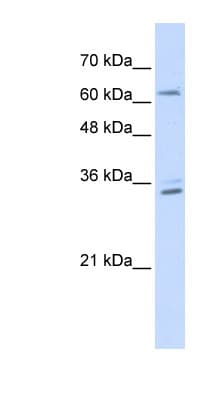 Polyclonal Rabbit anti-Human RELB Antibody (aa503-552, WB)