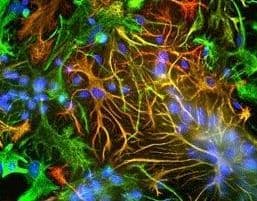 GFAP Antibody