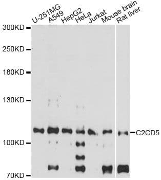 KIAA0528 Antibody
