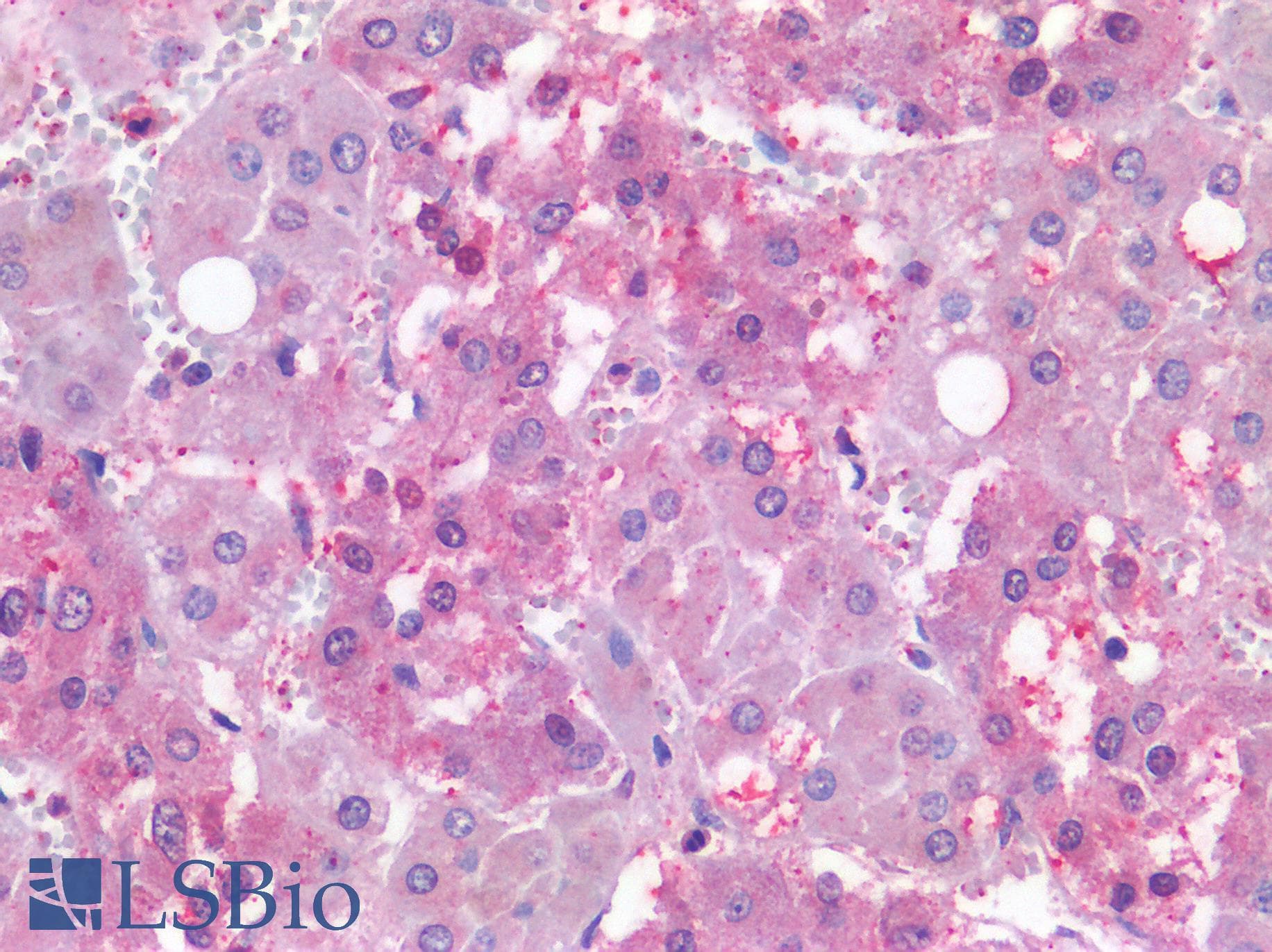 PathPlus™ NR5A1 / SF1 Antibody (Internal)