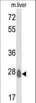 IHC-plus™ Polyclonal Rabbit anti-Human ETHE1 Antibody (aa180-209, IHC, WB)