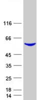 Human DPYS / Dihydropyrimidinase Protein (Recombinant Myc-DDK (Flag))
