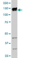 IHC-plus™ TOPORS Antibody (clone 5G11)