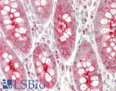 Monoclonal Mouse anti-Human CEACAM5 / CD66e Antibody (clone 1105, IHC, WB)