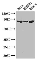 PFKM / PFK-1 Antibody