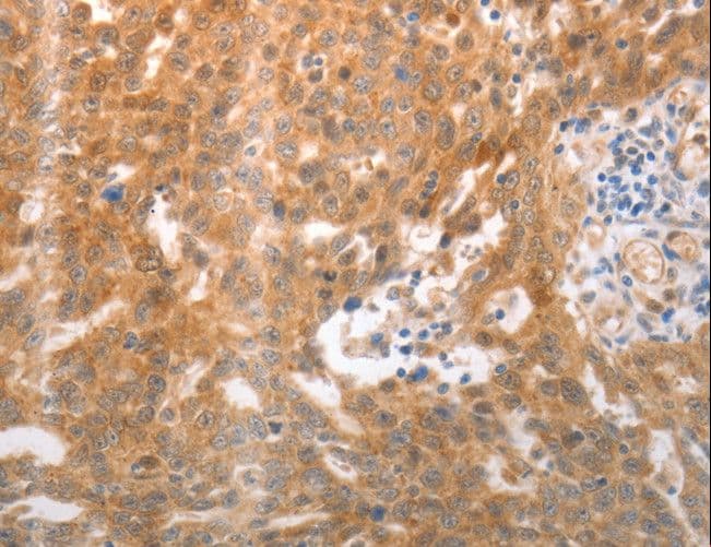 NQO1 Antibody