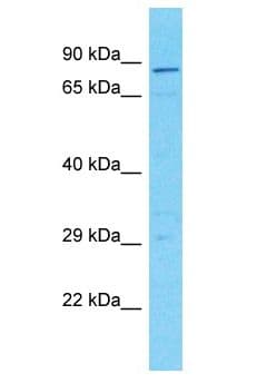 RINT1 Antibody (aa4-53)