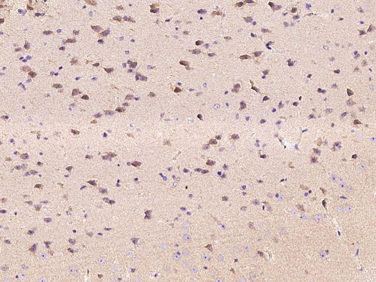 EPHA6 / EPH Receptor A6 Antibody (Preservative Free)