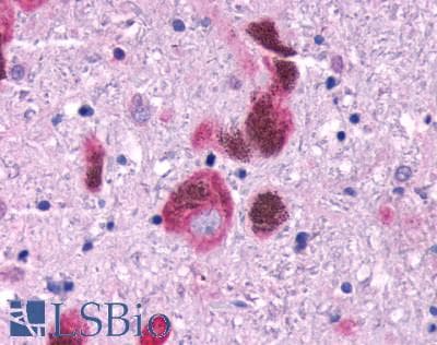 PathPlus™ FFAR1 / GPR40 Antibody (C-Terminus)