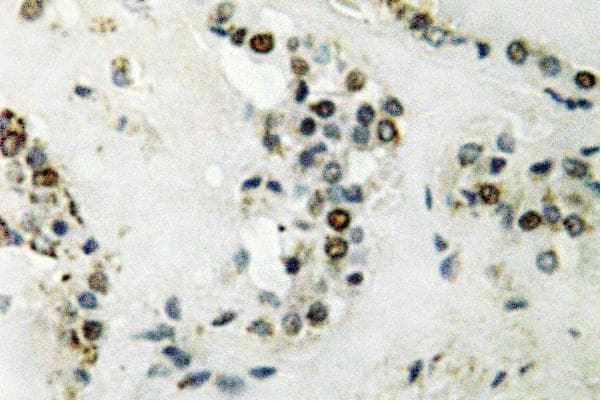 CCNE2 / Cyclin E2 Antibody (Asn387)
