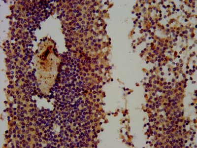 Polyclonal Rabbit anti-Human THEMIS / SPOT Antibody (IF, WB)