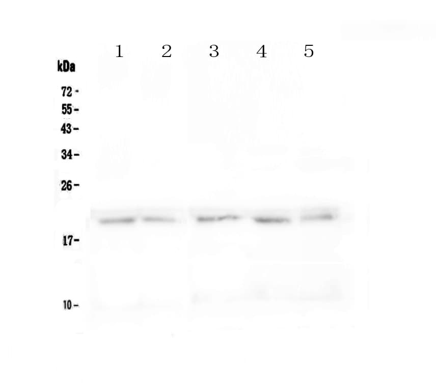 TNFRSF17 / BCMA Antibody