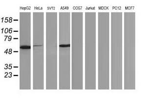 Monoclonal Mouse anti-Human TP53 / p53 Antibody (clone OTI3D5, IHC, IF, WB)