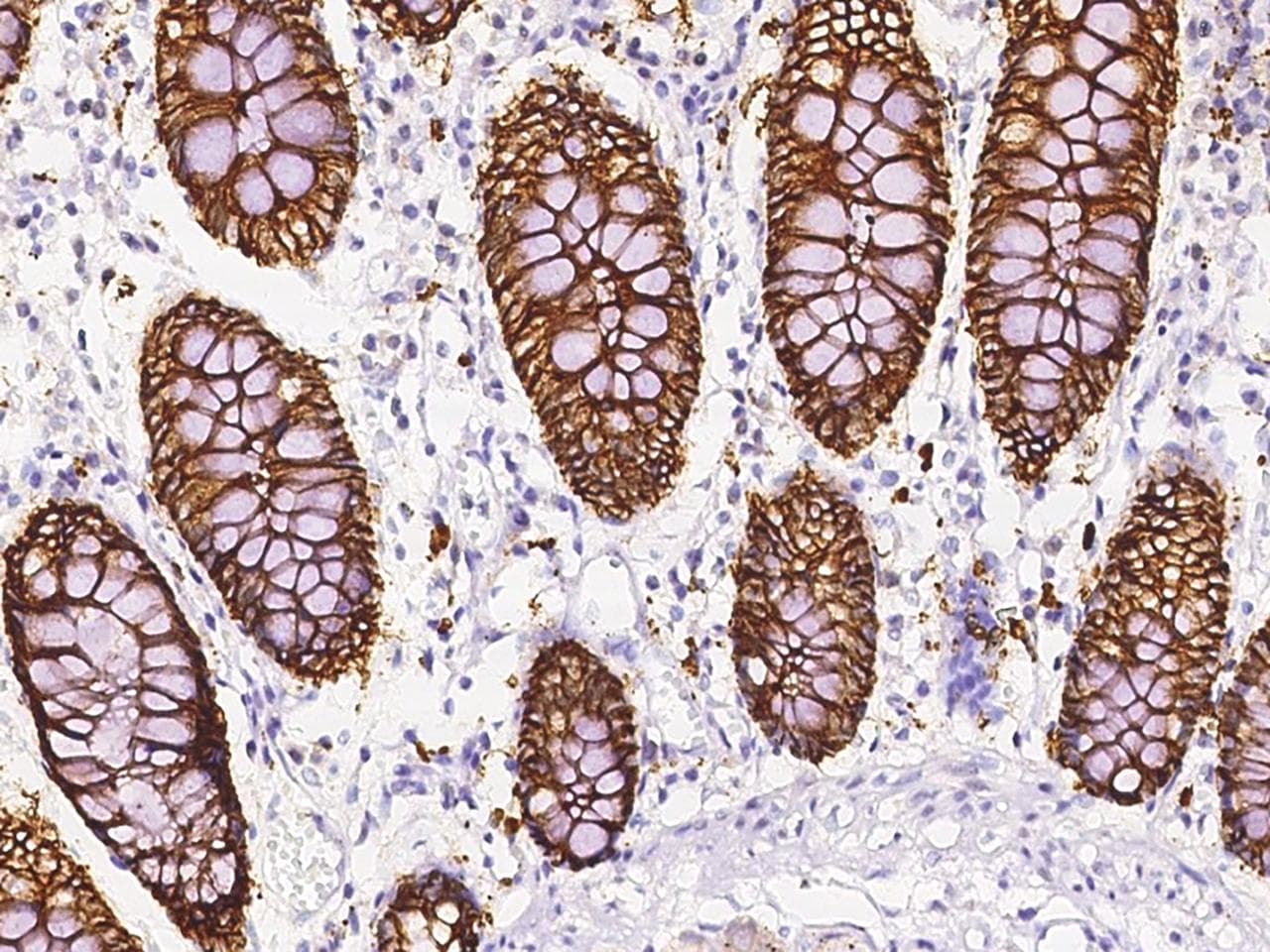CO-029 / TSPAN8 Antibody