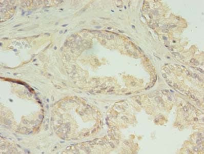 Polyclonal Rabbit anti-Human CHMP7 Antibody (IHC)