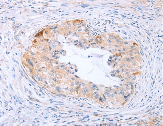 CARD6 Antibody