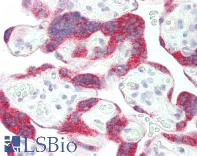 IHC-plus™ LRAT Antibody (aa89-138)