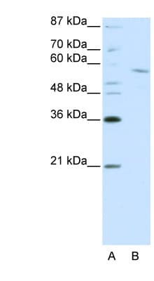 RCOR1 / COREST Antibody (C-Terminus)