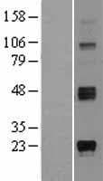 Human ST8SIA1 Protein (Over-Expression Lysate Myc-DDK (Flag))