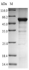 Human GNAZ Protein (Recombinant 6His-SUMO, N-terminus)