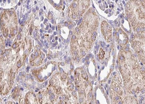 Polyclonal Rabbit anti-Human FKBP10 / FKBP65 Antibody (IHC, WB)