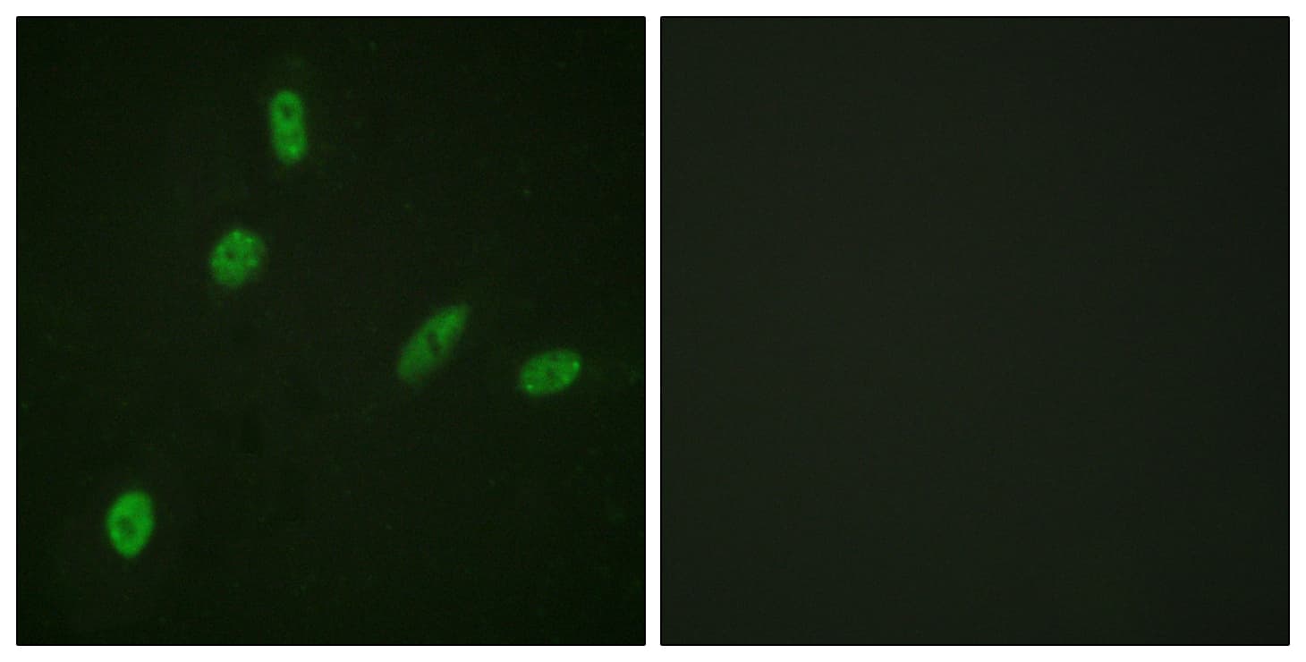 ETS1 / ETS-1 Antibody (aa11-60)