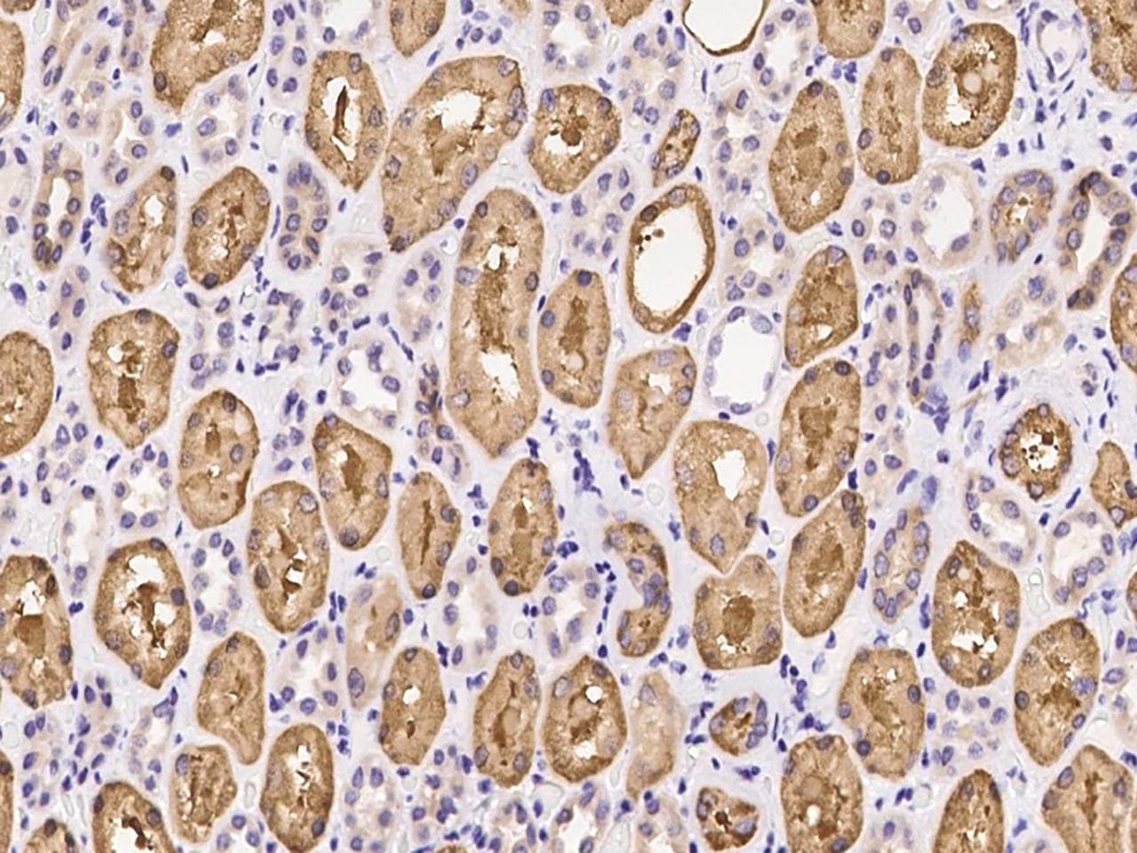Polyclonal Rabbit anti-Human SHMT / SHMT1 Antibody (IHC, IF)