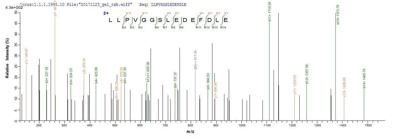 Human ASPRV1 / SASPase Protein (Recombinant 10His, N-terminus + Myc, C-terminus)
