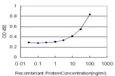FOXD1 Antibody (clone 2C10)