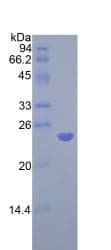 Rat COMT Protein (Recombinant His)