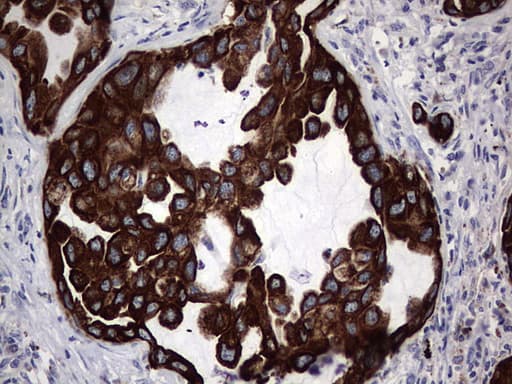 Monoclonal Rat anti-Human Acidic Cytokeratin Antibody (clone 9H3, IHC)