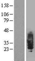 SIT1 Protein (Over-Expression Lysate Myc-DDK (Flag))