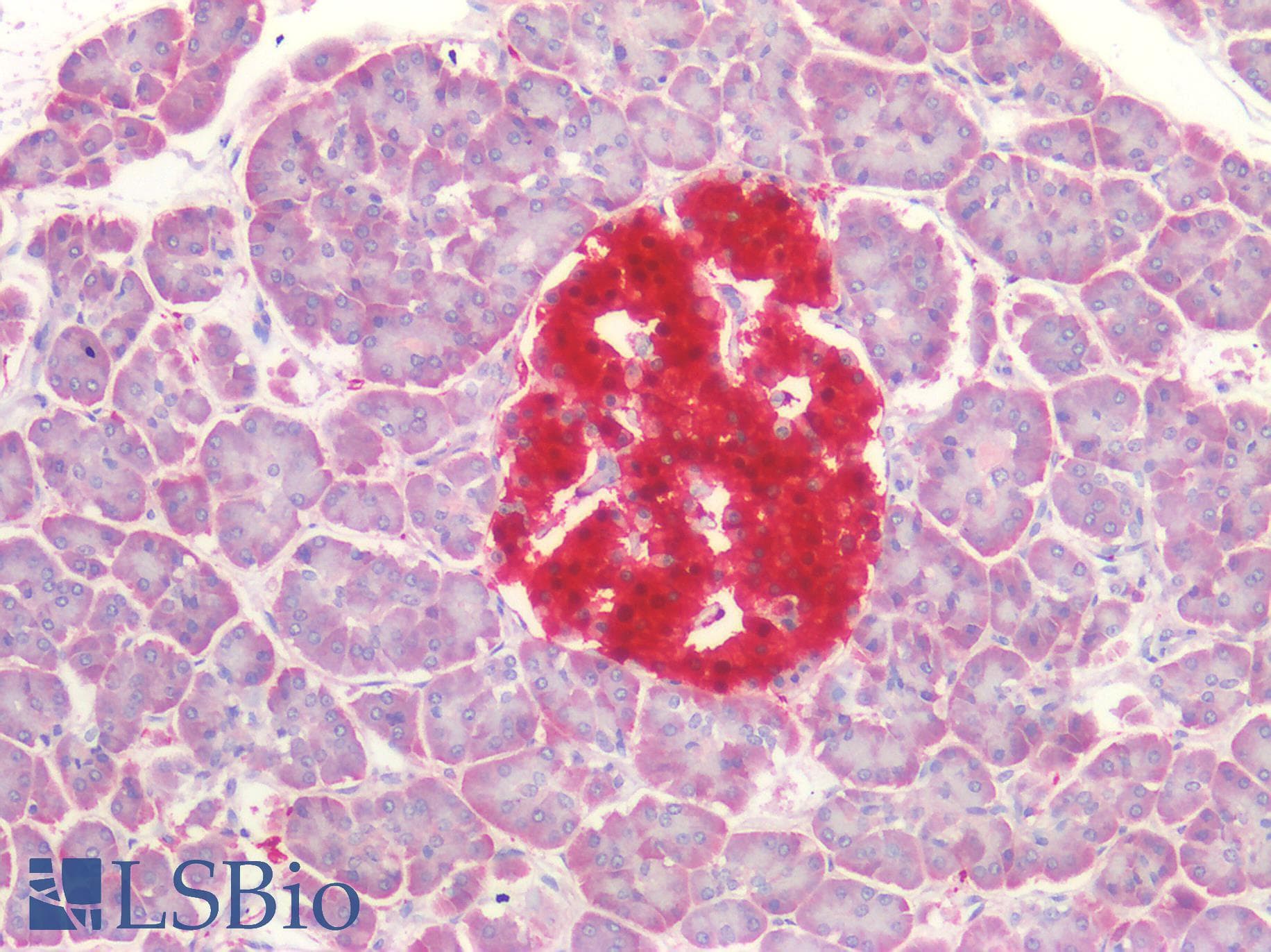 PathPlus™ UCHL1 / PGP9.5 Antibody
