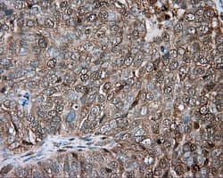 PRKAR2A Antibody (clone OTI1C4)