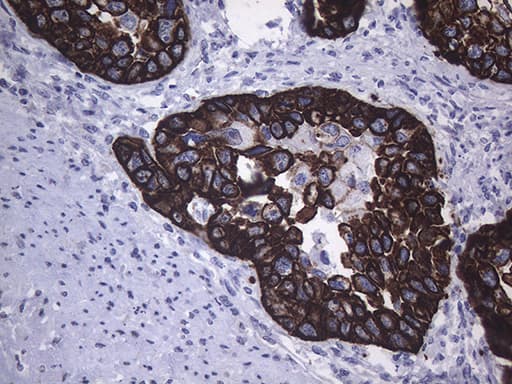 KRT16 / CK16 / Cytokeratin 16 Antibody (clone OTI2F3)