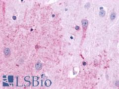 PathPlus™ Polyclonal Rabbit anti-Human TACR3 / NK3R Antibody (N-Terminus, IHC)