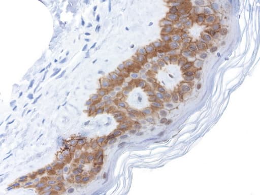 CDH1 / E Cadherin Antibody (clone UMAB184)