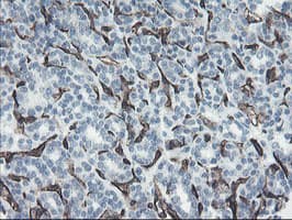 PECAM-1 / CD31 Antibody (clone OTI2B5)