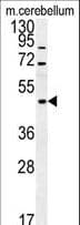 FUS / TLS Antibody (aa499-526)