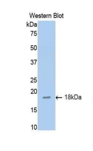 TNFRSF10B / Killer / DR5 Antibody (aa54-180, Biotin)