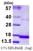 Human CST9 Protein (Recombinant His)